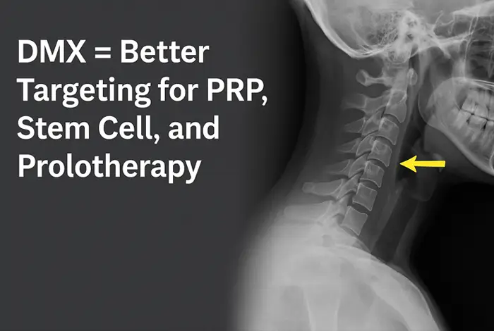 Cervical spine X-ray with a yellow arrow pointing to an unstable vertebra, illustrating how DMX improves targeting for PRP, stem cell, and prolotherapy treatments.