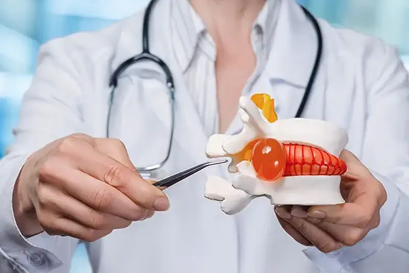 Doctor holding a spinal model and pointing to a herniated disc with a tool, demonstrating spinal anatomy and disc issues.









