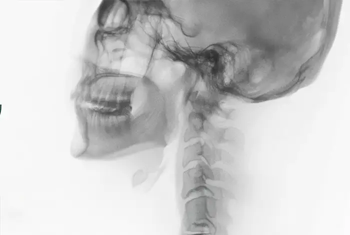 Informational page from DMX Miami explaining the use of Digital Motion X-Ray to detect hidden cervical injuries after accidents, especially valuable for legal and insurance cases.