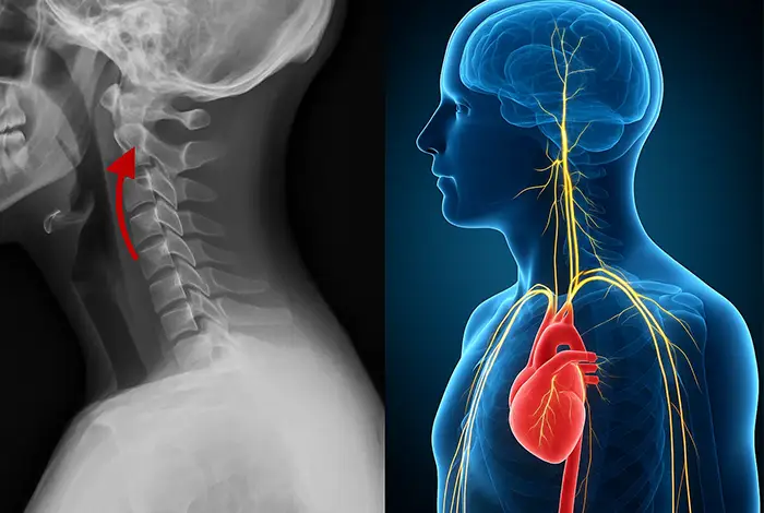 dysautonomia